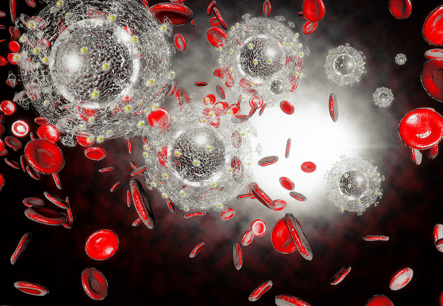 Immune Deficiency California Immune System Testing Treatment Premium Immune deficiency california immune system testing treatment premium